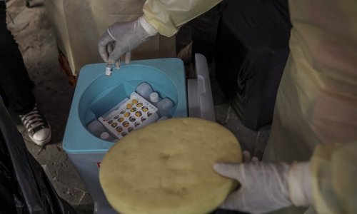 U Njemačkoj otkriven prvi slučaj opasnog novog soja boginja: Ovo su simptomi