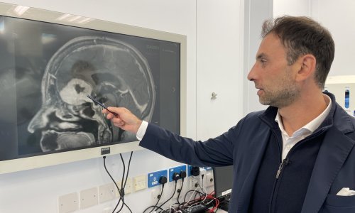 Kirurg uklanja tumor na mozgu veličine jabuke - kroz obrve