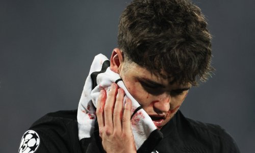 Strašna ozljeda mlade zvijezde Barcelone: Srbin ga je kopačkom opalio po licu