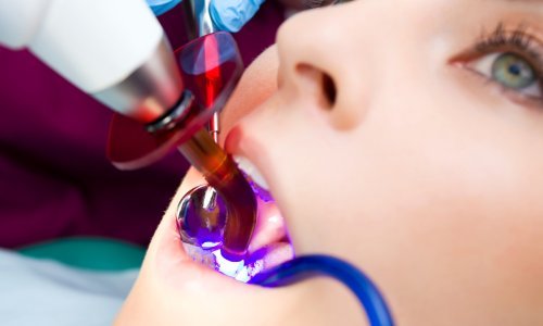 Zračenje čeljusti i zuba može izazvati rak štitnjače