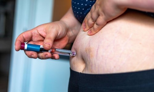 Broj oboljelih od dijabetesa se udvostručio: 59 posto njih se uopće ne liječi