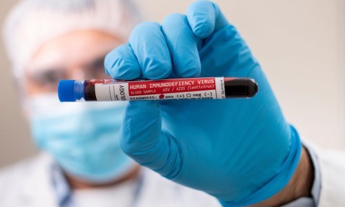 O ovoj se ozbiljnoj bolesti više ne priča mnogo, a ove se godine zarazilo 58 osoba