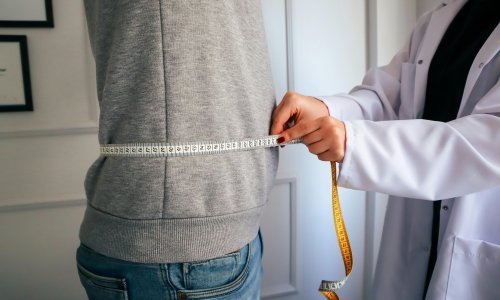 Debljina poprimila pandemijske razmjere: Evo kakve sve posljedice donosi