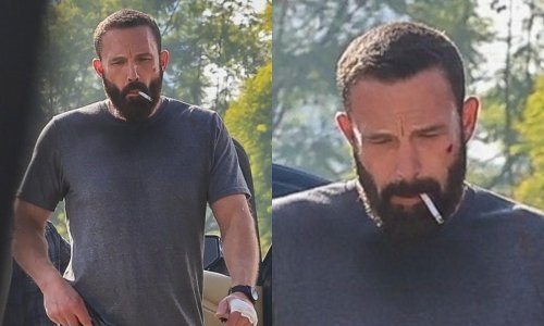Umor na licu Bena Afflecka govori više od riječi, a ozljeda na licu zabrinula je sve