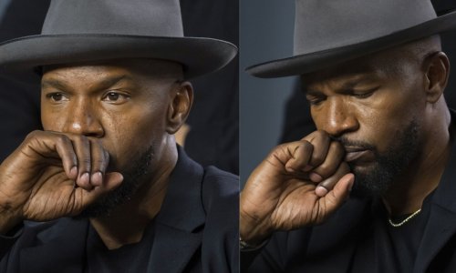 Jamie Foxx je završio u bolnici: Čaša ga pogodila za vrijeme tučnjave pa su ga šivali