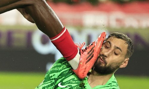 Pogledajte strašnu ozljedu Donnarumme; lice mu je unakaženo