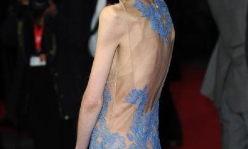 Anoreksična glumica izazvala zgražanje