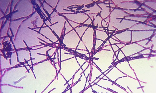 U Sloveniji sedam teladi uginulo od bedrenice