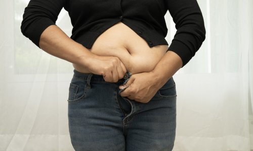 Za pretilost je potrebna nova definicija: BMI ne otkriva ništa o pacijentovu sveukupnom zdravlju