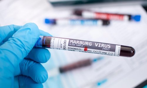 Tanzanija potvrdila novi slučaj zaraze virusom Marburg