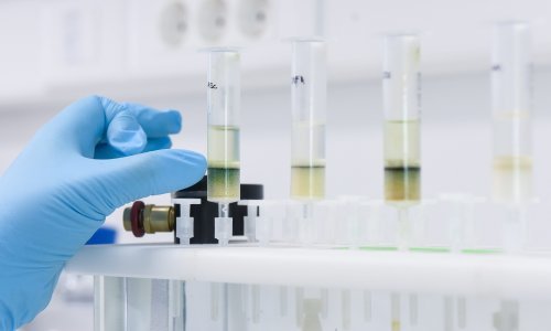 Europa na udaru spolno prenosivih bolesti: Opasna infekcija širi se brže nego ikad