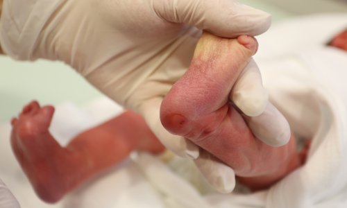 Rodila pa tužila bolnicu: 'Odmah je bilo jasno da nešto nije u redu...'