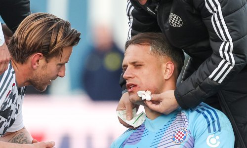 Stigle prve fotografije teških ozljeda Lučića