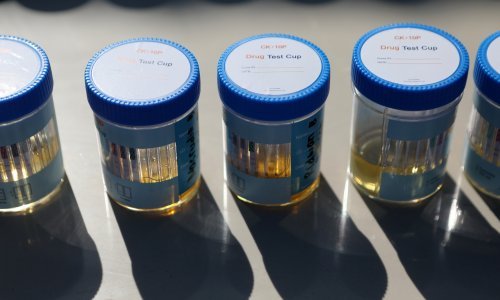 Veliki potencijal urina; u Parizu planiraju skupljati po restoranima u toaletima bez vode