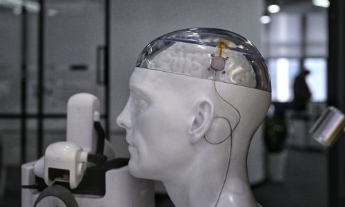 Noland u mozgu ima Muskov čip. Otkrio je koliko mu pomaže i čemu se nada