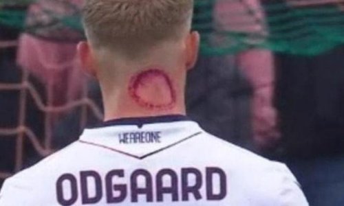 Ogromna rana na vratu šokirala navijače, zvijezda Serie A objasnila o čemu se radi