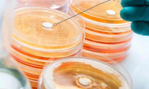 Ruđerovci otkrili 'sebične' bakterije u hrvatskim jezerima