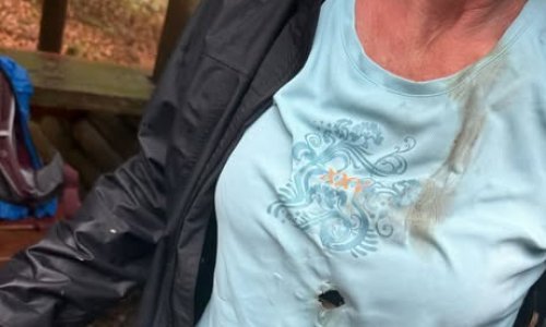 Ženu pogodila munja u prsa. Gorska služba spašavanja objavila fotografiju