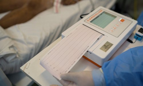 Kardiolog: Ovih pet stvari morate učiniti prije nego bude prekasno
