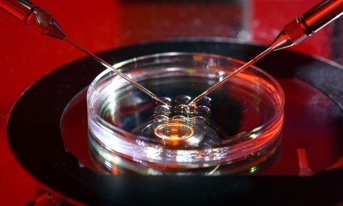 Sperma rizičnog donora koristila se za začeće desetaka djece u Europi: Desetoro ih dobilo rak