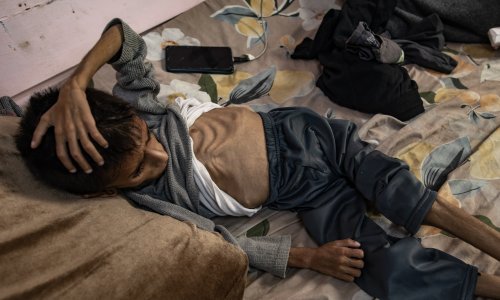 Rat u Gazi najviše pogađa djecu; svako deseto je pothranjeno