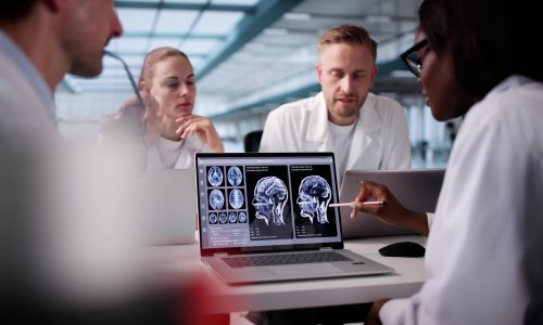 Stvoren prvi atlas ljudskog mozga: Ključ za razumijevanje autizma i shizofrenije?