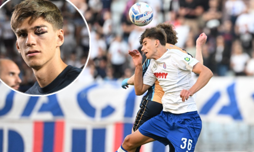 Problem za Hajduk; ozlijedio se stoper koji je trebao startati protiv Zire