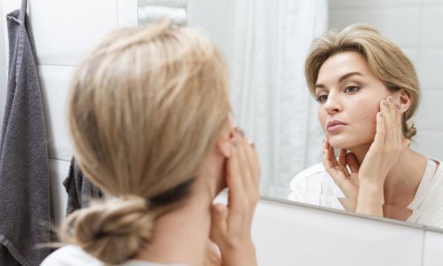 Stručnjaci za ljepotu kunu se u ovaj fenomen: Znate li što je notoks?