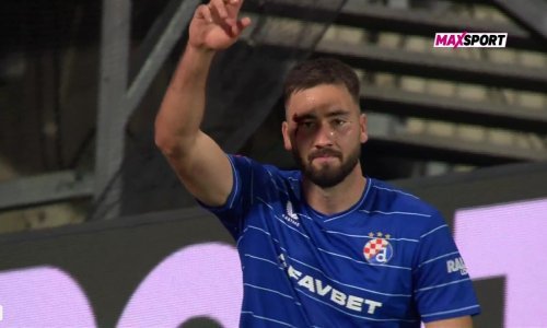 Pogledajte nevjerojatnu situaciju! Beljo zabio, a onda mu suigrač razbio arkadu i potekla je krv