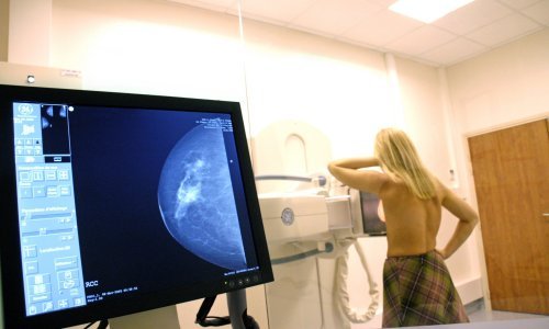 Istraživanje: Rađanje prvog djeteta u starijoj dobi povećava rizik od raka dojke