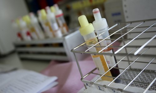 Projekti prikupljanja ljudskog urina: Smanjenje ovisnosti o kemikalijama u poljoprivredi