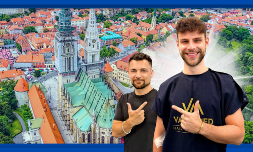 Recite zbogom ćelavosti: VatanMed je spremio novo iznenađenje