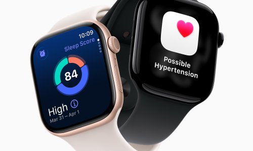 Što donosi sljedeći Apple Watch? Insajderi najavljuju dugo tražen senzor