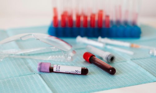 Novo otkriće: Jednostavan test otkriva više od 50 vrsta raka u ranoj fazi