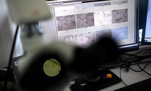 Popularna namirnica koja se najčešće patvori: Svaka četvrta tegla je neispravna