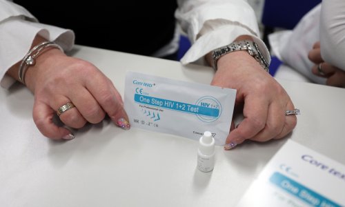 Ovaj tjedan u Zagrebu besplatno i anonimno testiranje na HIV i spolno prenosive bolesti