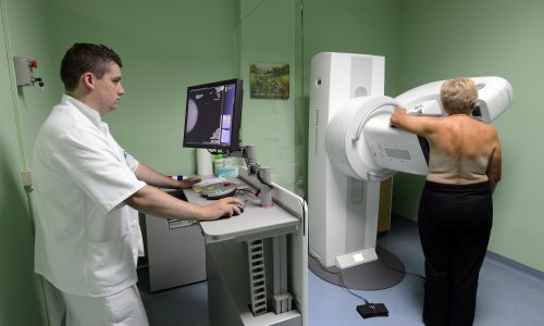 Odaziv na mamogarafiju je visokih 70 posto, ali cilj je još viši