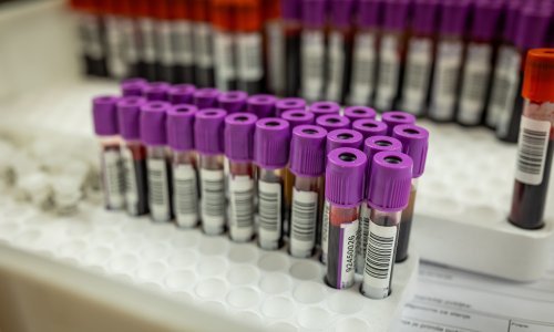 Apel sa zavoda: Zalihe sve manje, evo gdje možete darovati krv