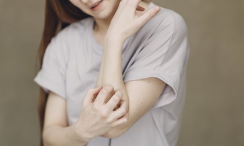 U Dubrovniku se pojavila šuga, evo koji su simptomi i kako se liječi