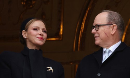 Zabrinjavajući prizori: Nakon misterioznih mrlja, princ Albert prvi put pokazao veliki ožiljak na licu