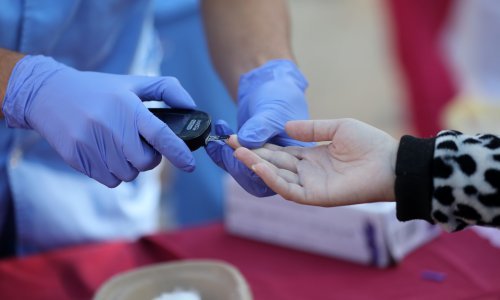 U Hrvatskoj 187 tisuća osoba s dijagnozom raka. Poznato je i koliki je postotak preživljenja