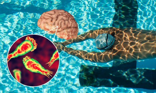 Uzbuna zbog rastuće globalne prijetnje: U vodi vreba ameba koja jede mozak