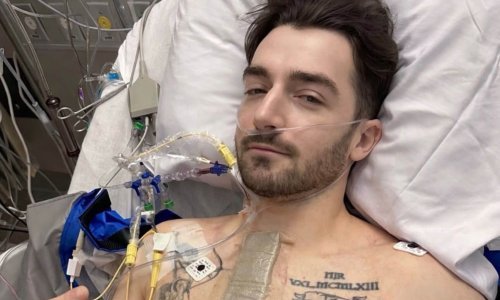 Sin Liama Neesona završio na operaciji srca: 'U oko dva posto ljudi javlja se ova mana'