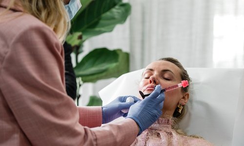 Usne koje izgledaju prirodno i zdravo: upoznajte novi beauty hit