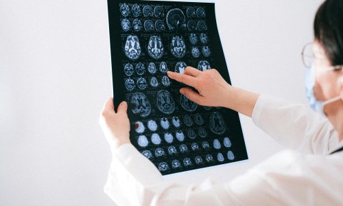 Kako naš mozak organizira znanje? Ovo otkriće je njemačkom znanstveniku donijelo prestižnu nagradu