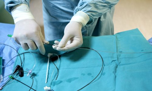 Zbog bolova završio u bolnici, liječnici u šoku: Evo što je nosio u sebi 20 godina