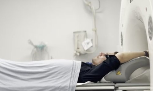 Sve više mladih obolijeva od ovih 11 vrsta raka: Znanost na tragu ključnog otkrića