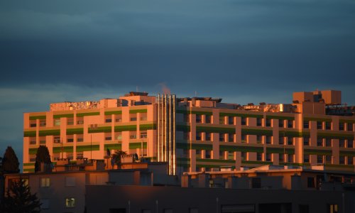 Veliki uspjeh pulske bolnice: Prvia biopsija dojke 'kontrastno pojačanom mamografijom'