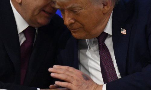 Modrice na rukama i pitanja o zdravlju: Trump ide na pregled u vojnu bolnicu