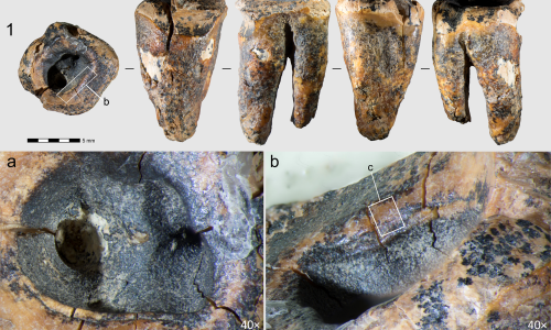 Znanstvenici imaju dokaze: Neandertalci su prije 59 tisuća godina imali - zubare